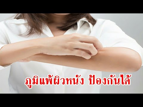 จะได้หายไปจากจุดที่อยู่ในผิวหนังของโรคสะเก็ดเงิน การประยุกต์ใช้ไม้เรียว tar ใจจากโรคสะเก็ดเงิน