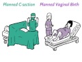Cesarean Or Vaginal Delivery For Twins NEJM