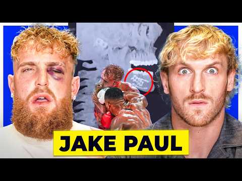 Jake Paul on Getting KO'd by Anthony Joshua, $92,000,000 Payday, Quitting Boxing After Broken Jaw