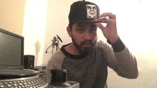 Week 45 on minoxidil