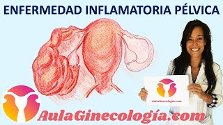 ENFERMEDAD INFLAMATORIA PÉLVICA (EPI): Síntomas y tratamiento   - Ginecología y Obstetricia -