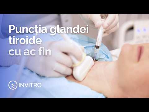 How a biopsy of thyroid gland nodules is performed