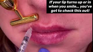 Watch this to learn why everyone is obsessed with lip flips!