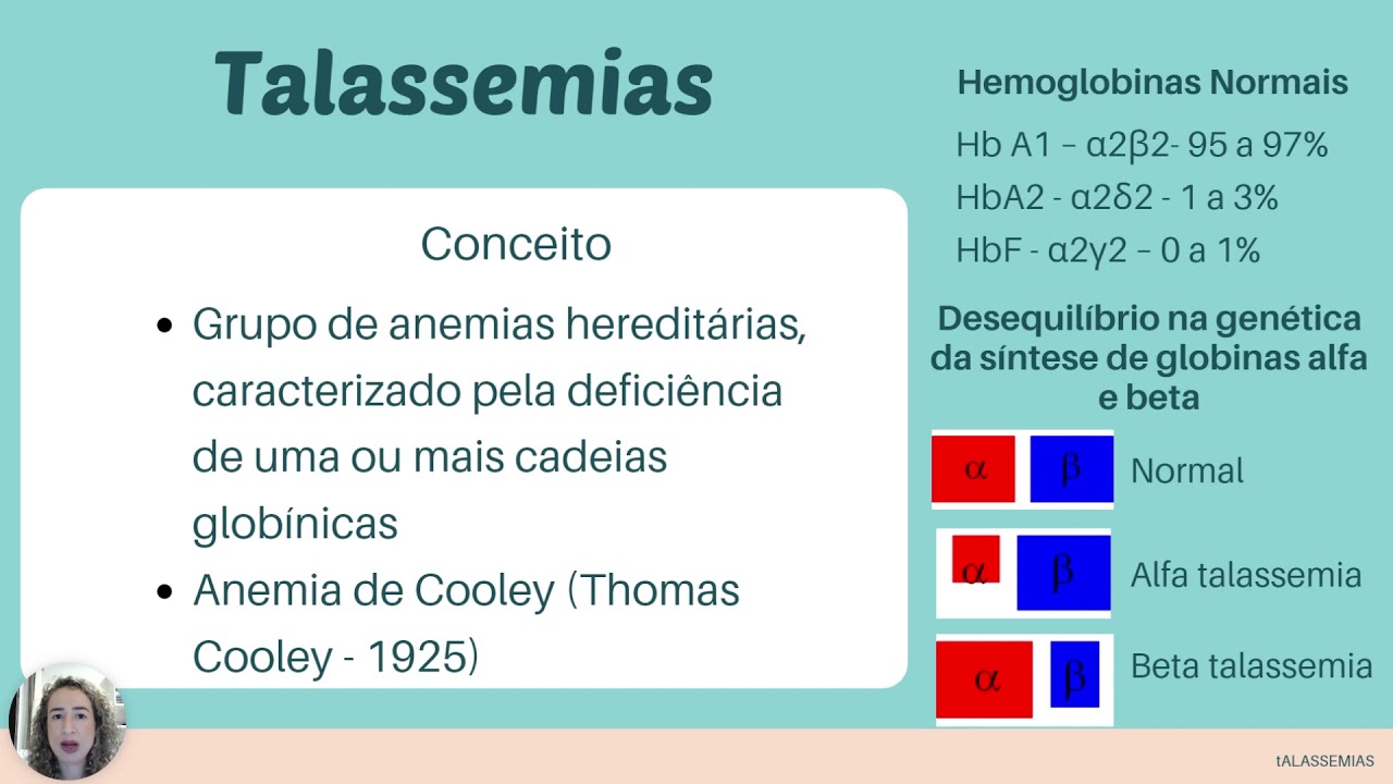 #hematologiaclínica#talassemias# Aula para acadêmicos, sobre Talassemias- ênfase em alfa talassemias