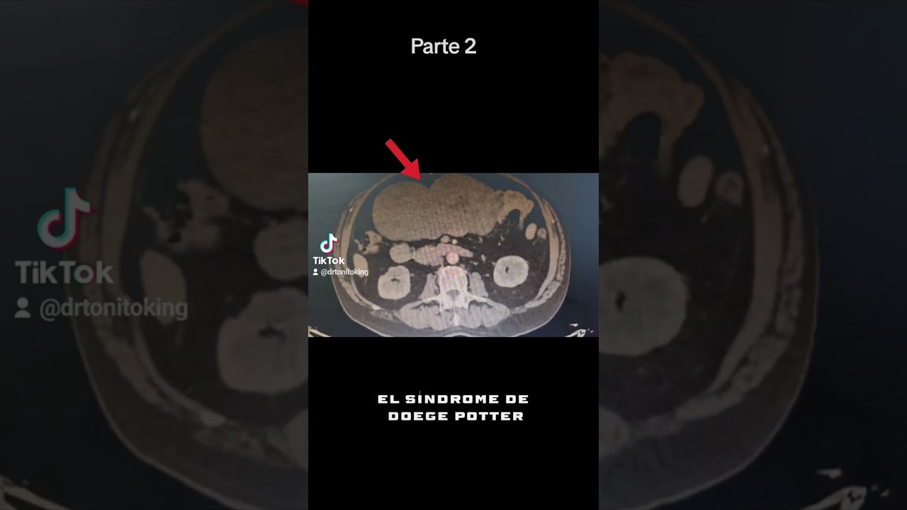 Marco Antonio García-6