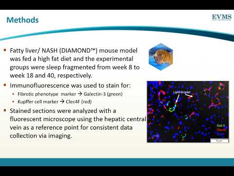 Thumbnail image of video presentation for Characterization of Lipid Droplet Associated Pro-fibrotic Macrophages in Sleep Fragmented Mice