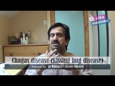 Chagas Disease (American Trypanosomiasis or Kissing Bug Disease) : Causes, Symptoms, Treatment