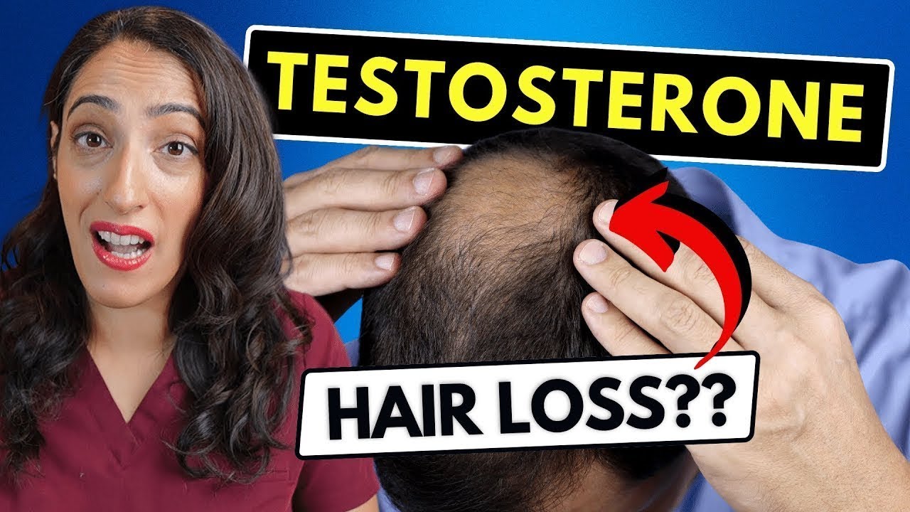 Will Testosterone Replacement Therapy (TRT) Make You Go Bald? thumnail