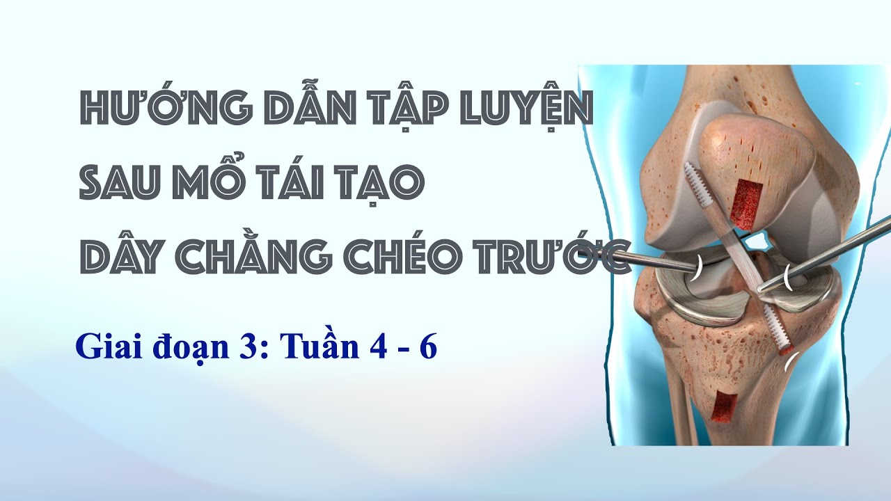 Hướng dẫn tập luyện sau phẫu thuật dây chằng chéo trước, giai đoạn 3, tuần 4 -6
