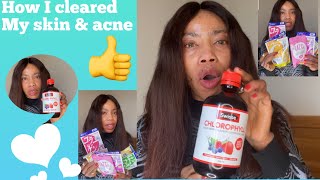 Download lagu DHC Japanese supplements and lazel gluta pure update,honest review #dhc #lazel #chlorophyll#Ruchi mp3
