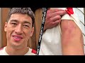 DMITRY BIVOL MORNING AFTER CANELO FIGHT SHOWS BRUISED ARM; SAYS HE WANTS 168 UNDISPUTED TITLES