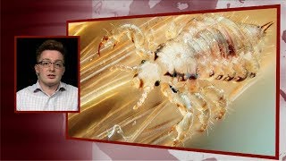 Scientists: Climate Change May Wipe Out Third of World's Parasites, With Disastrous Ripple Effects