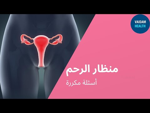 الأسئلة المتداولة حول تنظير الرحم