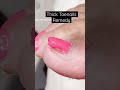 Thick toenails remedy. Let me show you how to restore your nails :) #dremel #electricfile #toenails