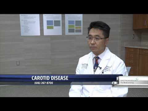 Understanding Carotid Artery Disease