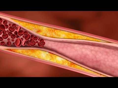 Only a Glass of This Juice will Remove Clogged Arteries And Control Blood Pressure