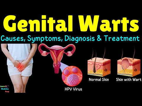 HPV Genital Warts: Causes, Symptoms, Diagnosis, Treatment, and Prevention Explained
