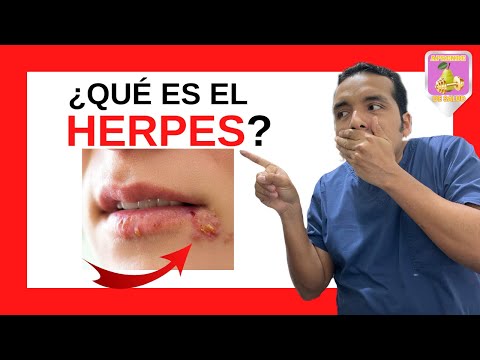 herpes genital y papiloma