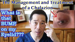 What is the bump on my eyelid?  Treatment of a Chalazion.