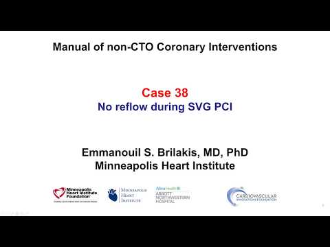 Case 38: PCI Manual: No reflow during SVG PCI