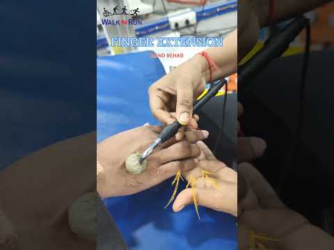 Physiotherapy for Hand Rehab - Finger Extension. #physiotherapy #fitness #physio #spinalcordinjury