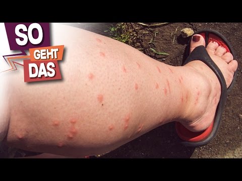 Probleme mit Blutgefäßen in Osteochondrose Komplexe Bewegungstherapie in Osteochondrose Kind