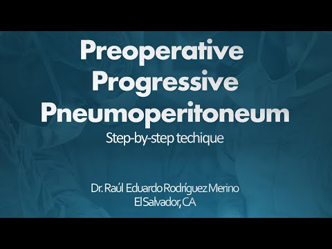 Preoperative Progressive Pneumoperitoneum Step-by-step technique for hernias with loss of domain