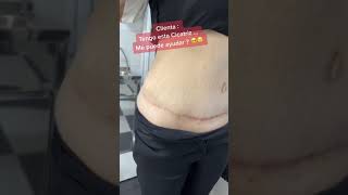 Tatuajes Para Tapar cicatrices En La Panza