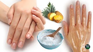 How To Remove Wrinkles From Hands Naturally in 2 Days