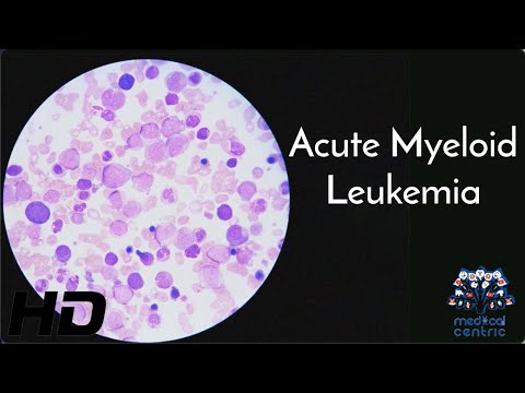 Pernicious Anemia Causes Signs and Symptoms Diagnosis and Treatment