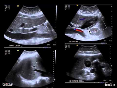 Webinar: Point-of-Care Ultrasound and the Hospitalist - Does it Matter?