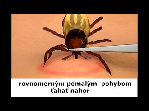 HPV gyógymód hímek számára