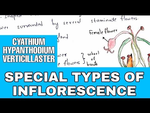 GLYCOLYSIS OR EMP PATHWAY BY PHANINDRA GUPTHA