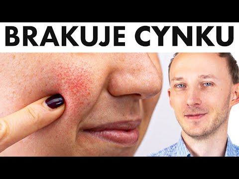 Tak ciało dopomina się o cynk. Typowe objawy niedoboru