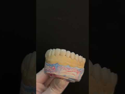 Lentes de porcelana unem planejamento, proporção e estética para transformar o sorriso com atenção a cada detalhe.