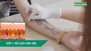 Top những loại kem xóa hình xăm vĩnh viễn hiệu quả nhất #55 Top những loại kem xóa hình xăm vĩnh viễn hiệu quả nhất
