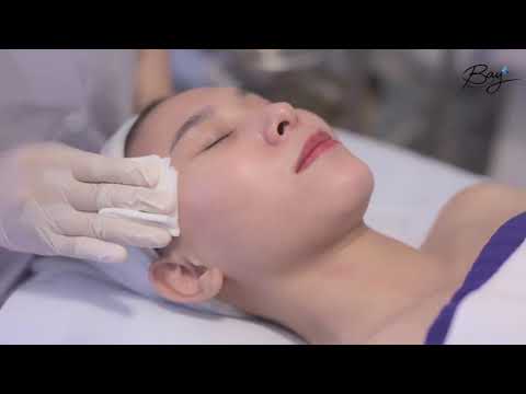 TCA Peel Tái Sinh Thế Hệ Mới - Bay Spa