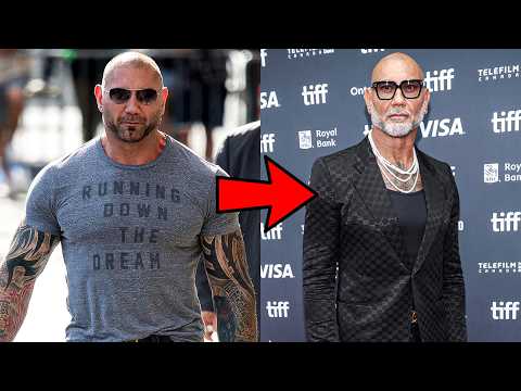 Dave Bautista Plastic Surgery
