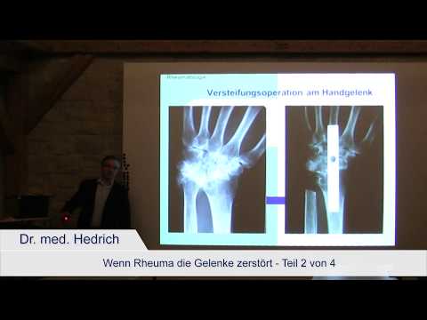 Schmerzen im unteren Rücken nach der Reinigung Gesehen Bad und Osteochondrose