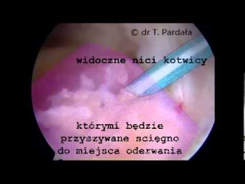 Ból w mięśniach rękach kobiet Przeziębienia mięśni na twarzy