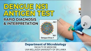Dengue NS-1 Antigen test