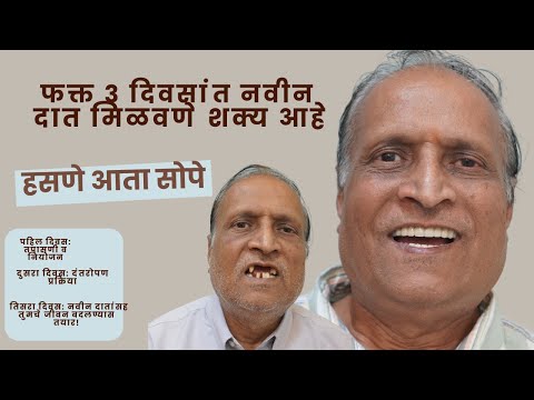 Full Mouth Implant in 3 Days — Madanlal Pardesi