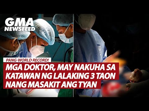 Mga doktor, may nakuha sa katawan ng lalaking 3 taon nang masakit ang tiyan GMA News Feed