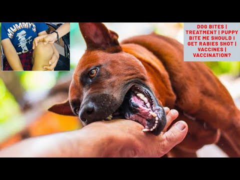 Puppy Bite me Should I get Rabies Shot | Vaccines - YouTube