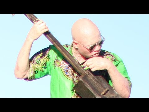 Lazarus - Standing up for persons with albinism