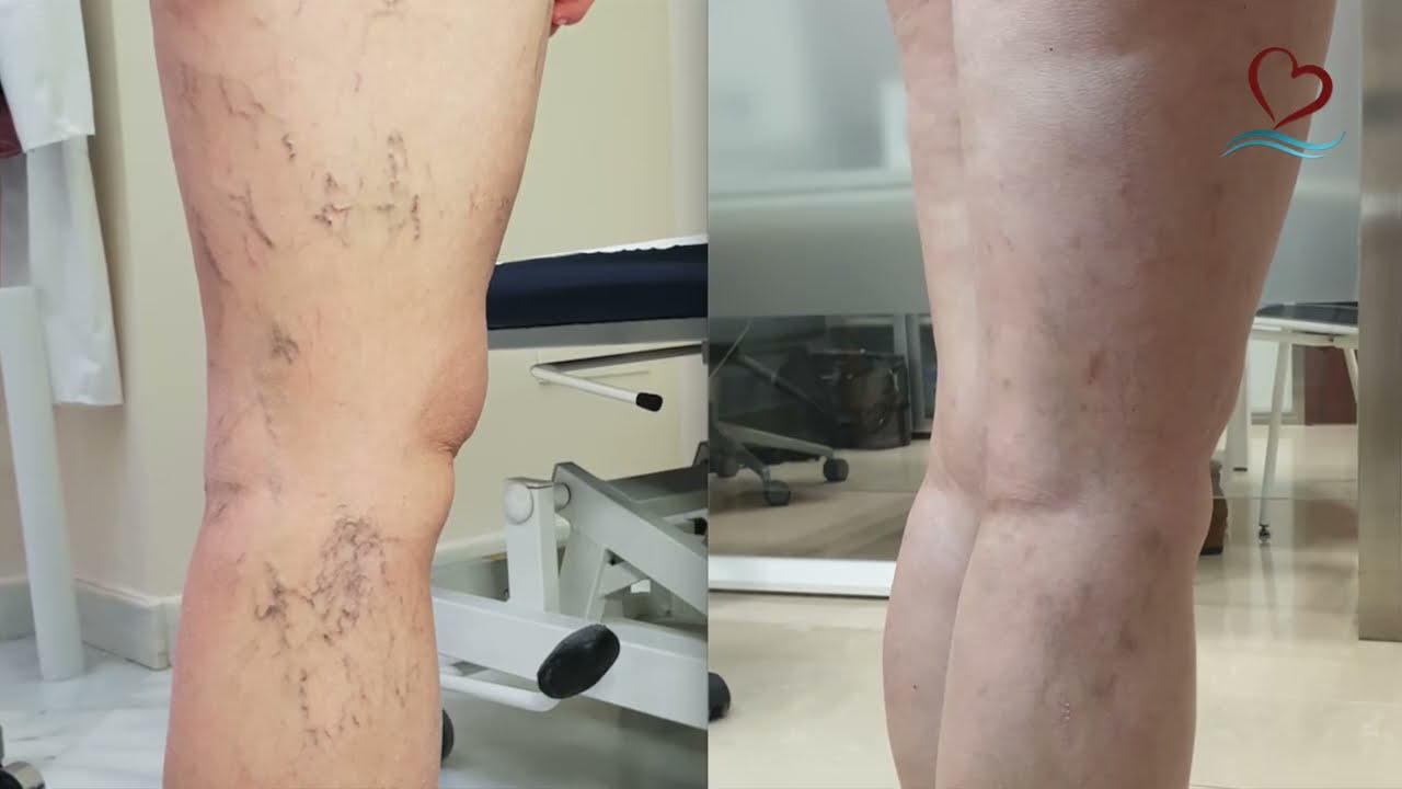 José Francisco Valderrama Marcos-16