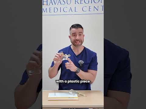 Shoulder Replacement Surgery Video