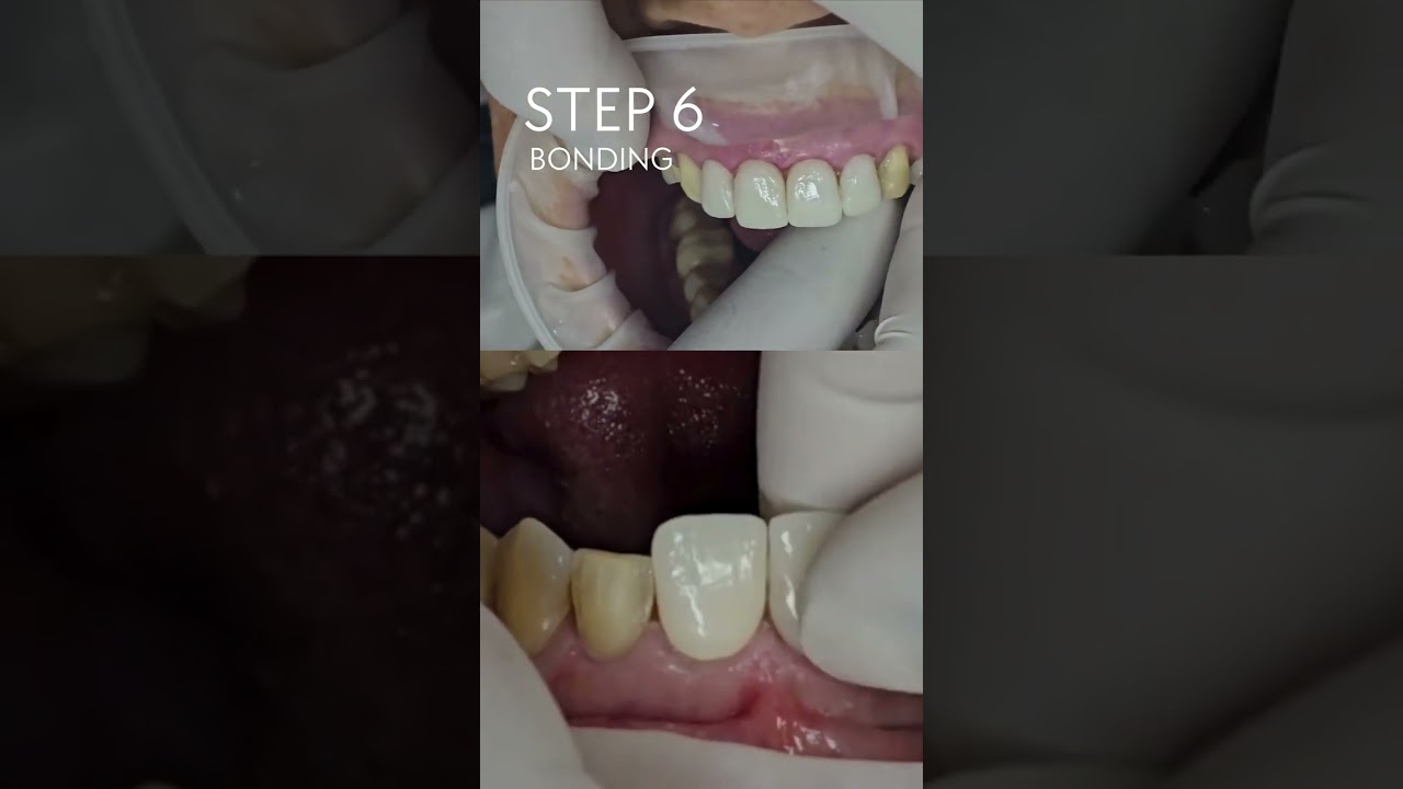 From Scan to Smile in One Day