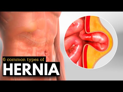 Effects of Cannabis on your body