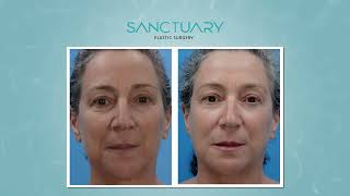 Sanctuary Plastic Surgery